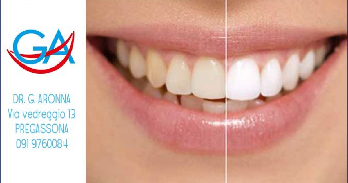 Dentista Lugano : In Collaborazione Con La Dr.ssa Maria Di Martino Che Si Occupa Di Parodontologia E Chirurgia Parodontale | Dentista Membro Sso A Lugano Per Ricordarti L�appuntamento Dall�igienista O Dal Dentista.