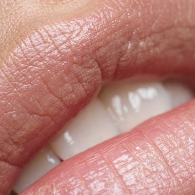 Come curare delle labbra secche e screpolate?