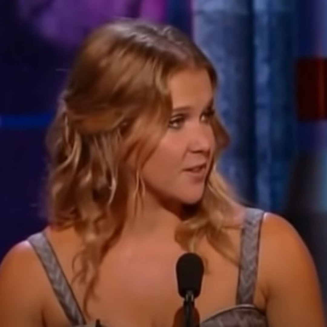 Amy Schumer ha eliminato i filler dalle guance