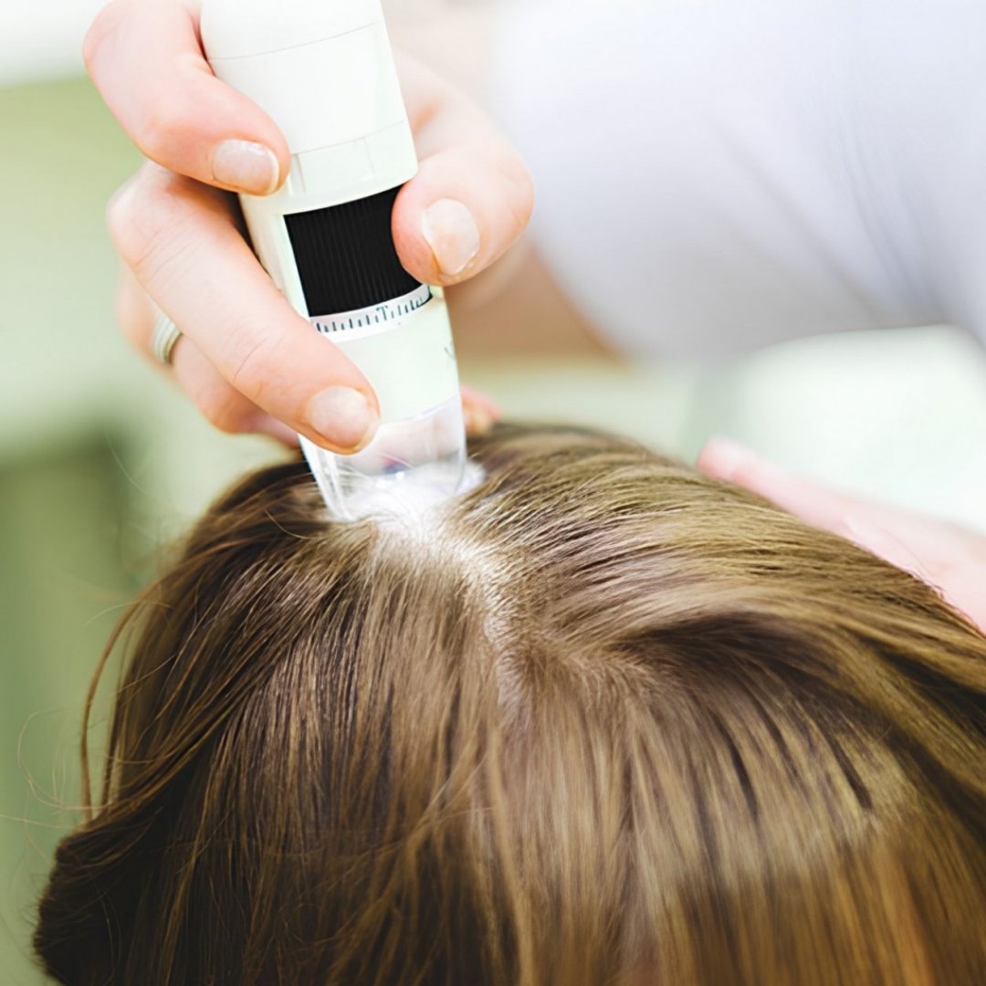 CRLAB Lugano: non solo trapianto e infoltimento, ma un approccio completo alla salute dei capelli